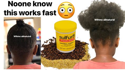 sulfur8 for hair growth|Iba pa.